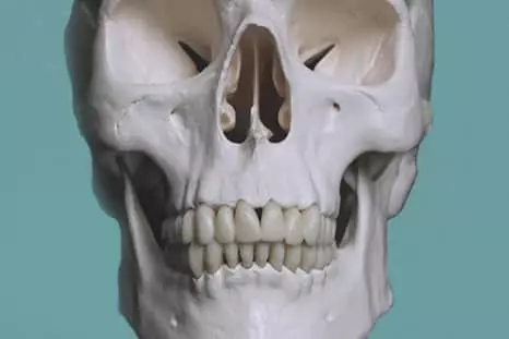 КТ челюсти